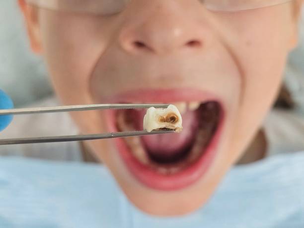 Dentist for Dental Trauma in TN