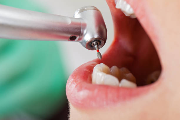 Best Dentist for Tooth Abscess  in Sale Creek, TN